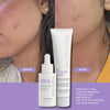 Blemish Control Duo